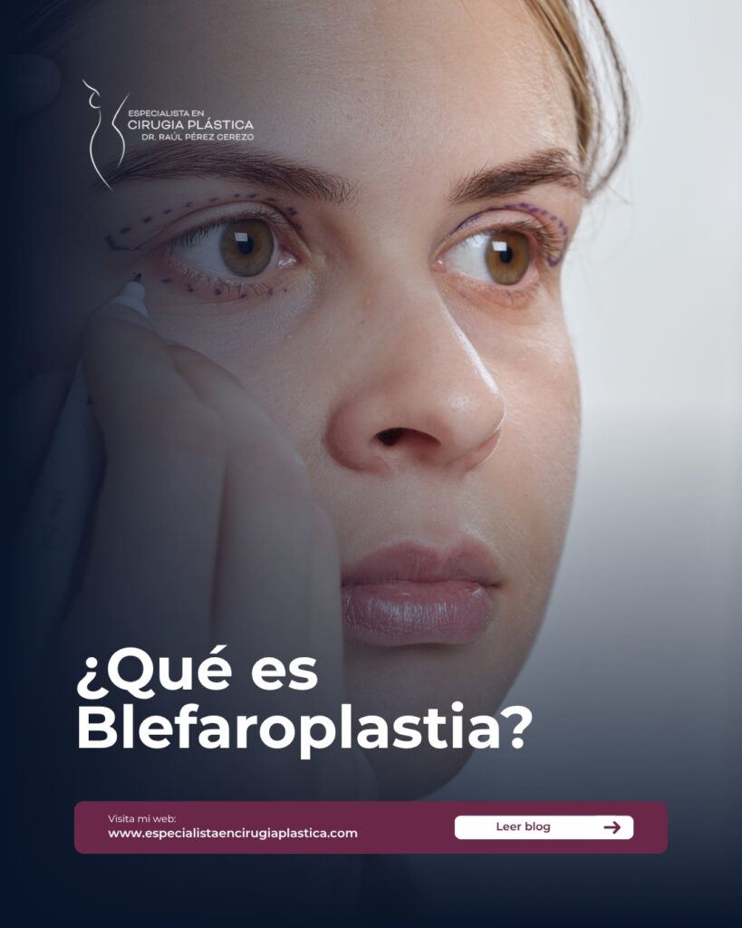 Qué es Blefaroplastia Qué es Blefaroplastia