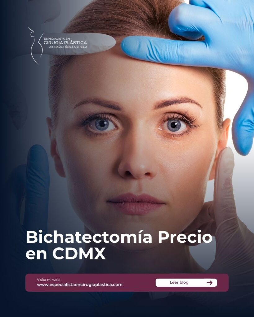 Bichatectomía Precio en CDMX Bichatectomía Precio en CDMX
