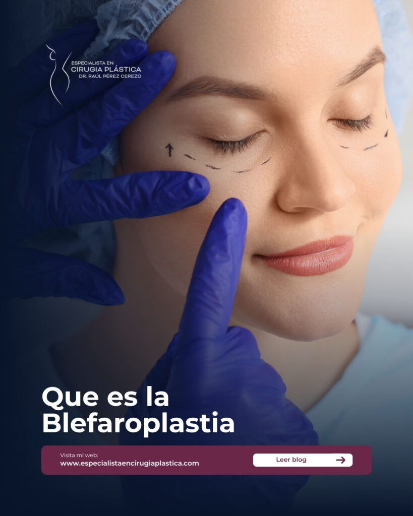 blefaroplastia blefaroplastia