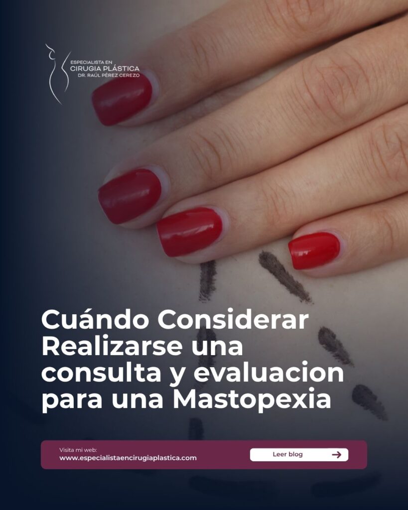Mamoplastia o Mastopexia Mamoplastia o Mastopexia