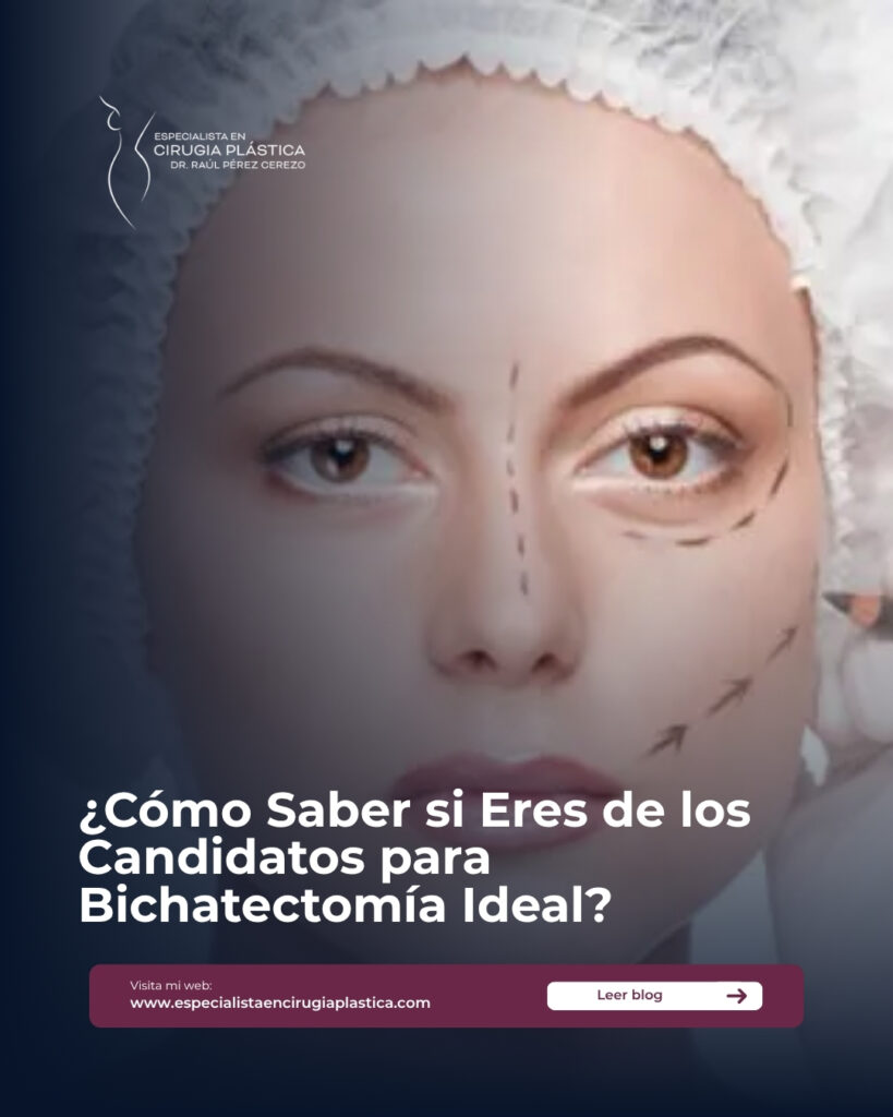 Candidatos para Bichatectomía Candidatos para Bichatectomía