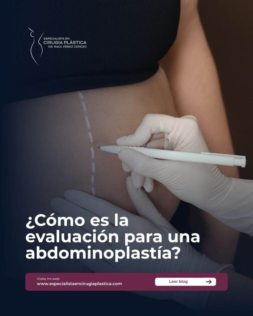 Cómo es la evaluación para una abdominoplastía