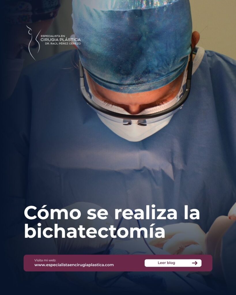 Cómo se realiza la bichatectomía Cómo se realiza la bichatectomía