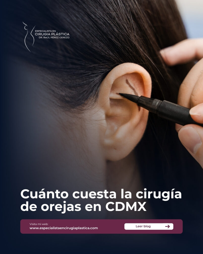 Precio Otoplastia Precio Otoplastia