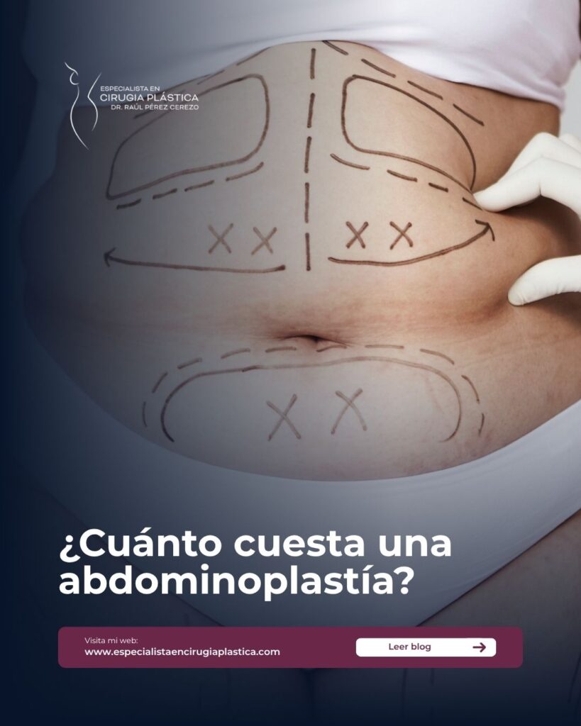 Cuánto cuesta una abdominoplastía Cuánto cuesta una abdominoplastía