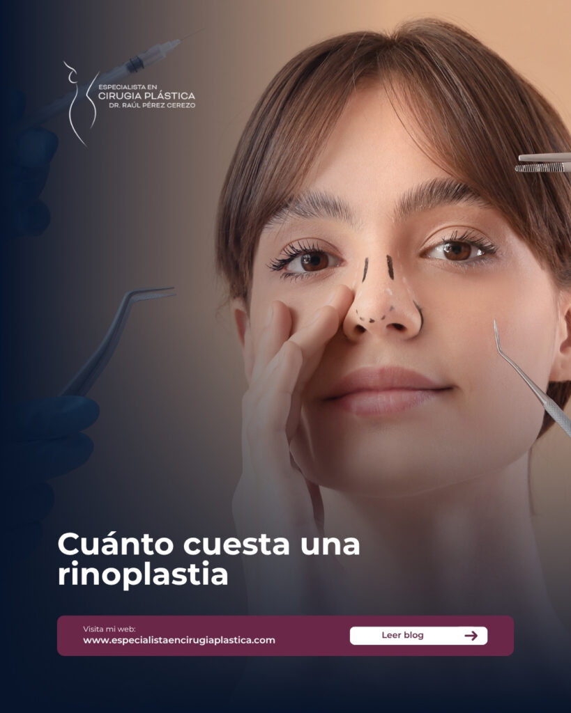 Cuánto cuesta una rinoplastia Cuánto cuesta una rinoplastia