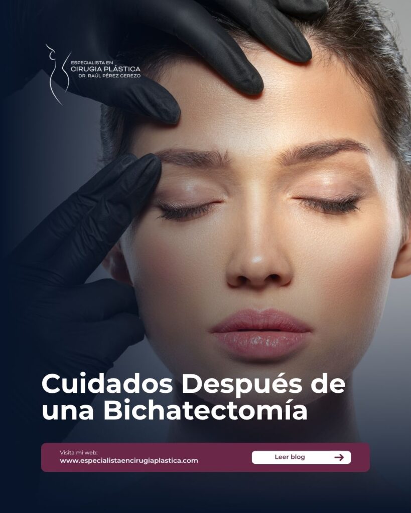 Cuidados Después de una Bichatectomía Cuidados Después de una Bichatectomía