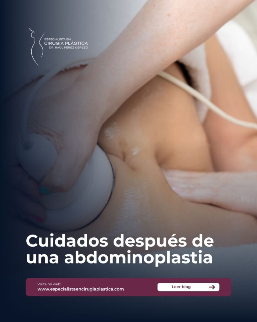 Cuidados después de una abdominoplastia
