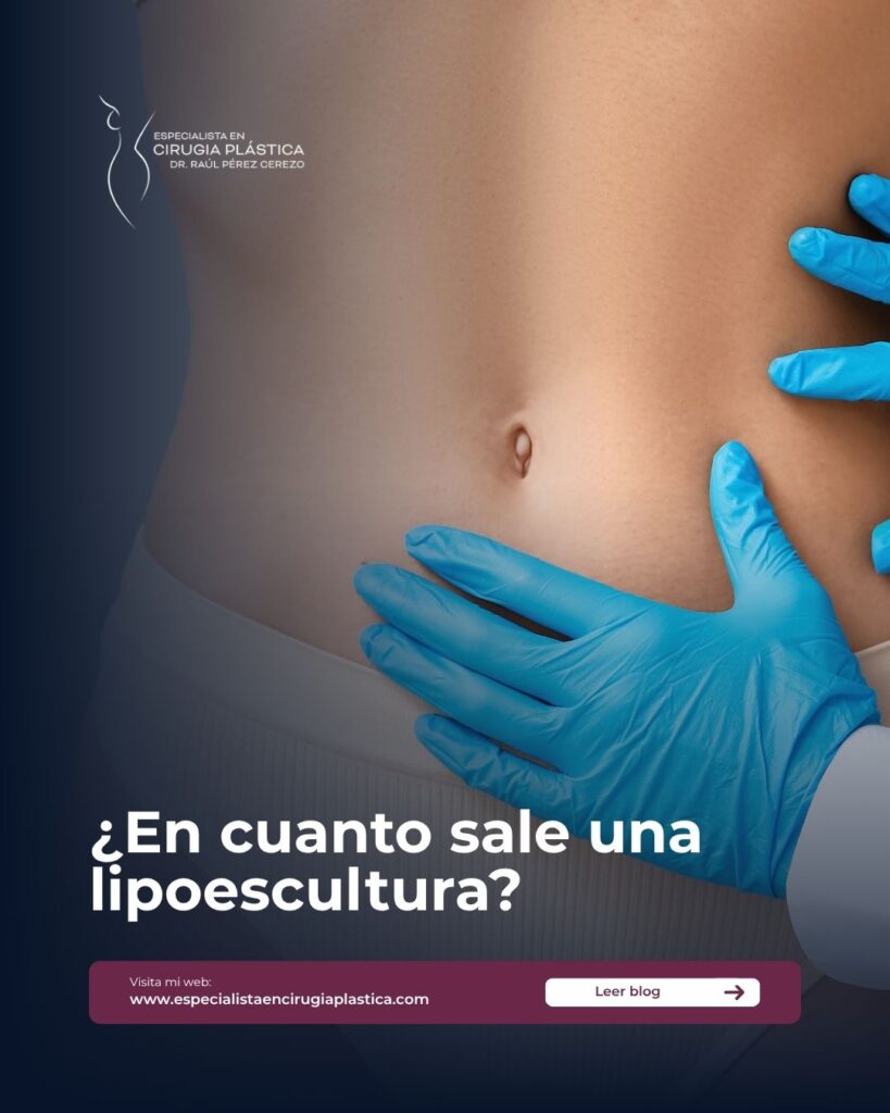 En cuanto sale una lipoescultura En cuanto sale una lipoescultura