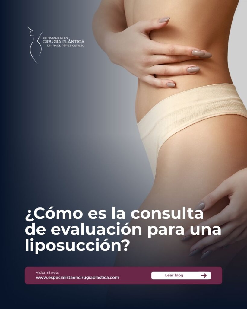 Liposucción en CDMX Liposucción en CDMX