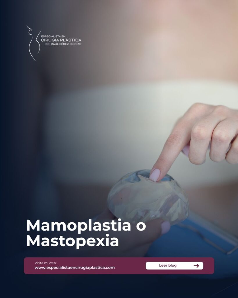 Mamoplastia o Mastopexia