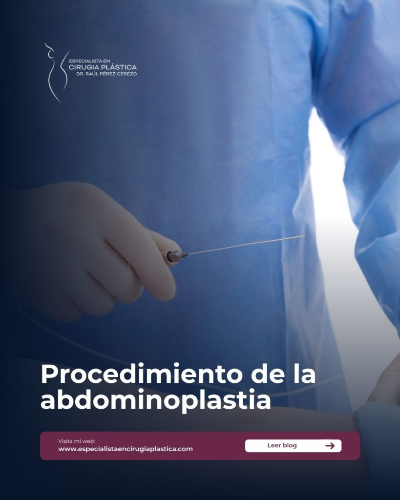 Procedimiento de la abdominoplastia