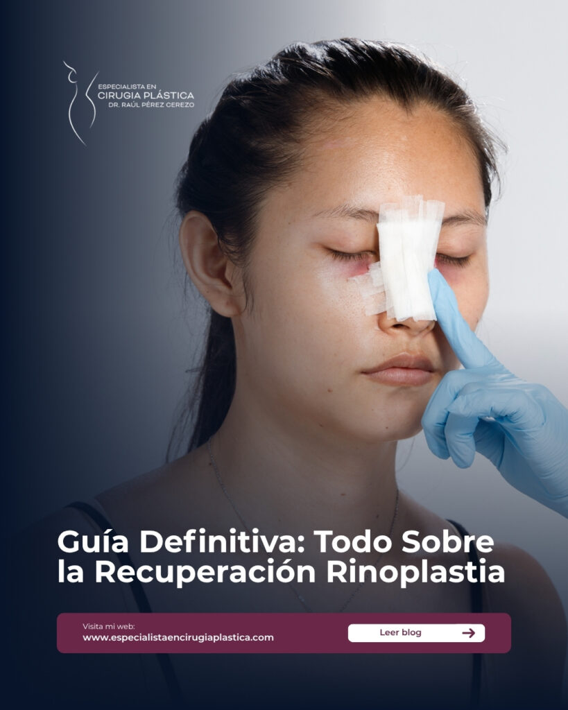 Recuperación Rinoplastia