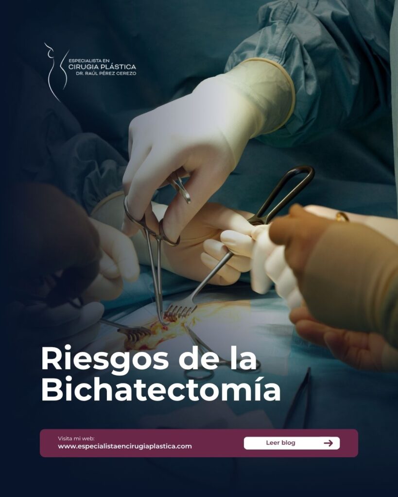 Riesgos de la Bichatectomía Riesgos de la Bichatectomía