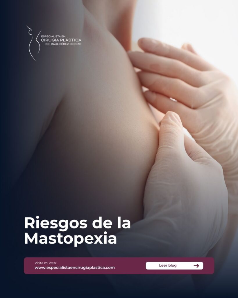 Riesgos de la Mastopexia Riesgos de la Mastopexia
