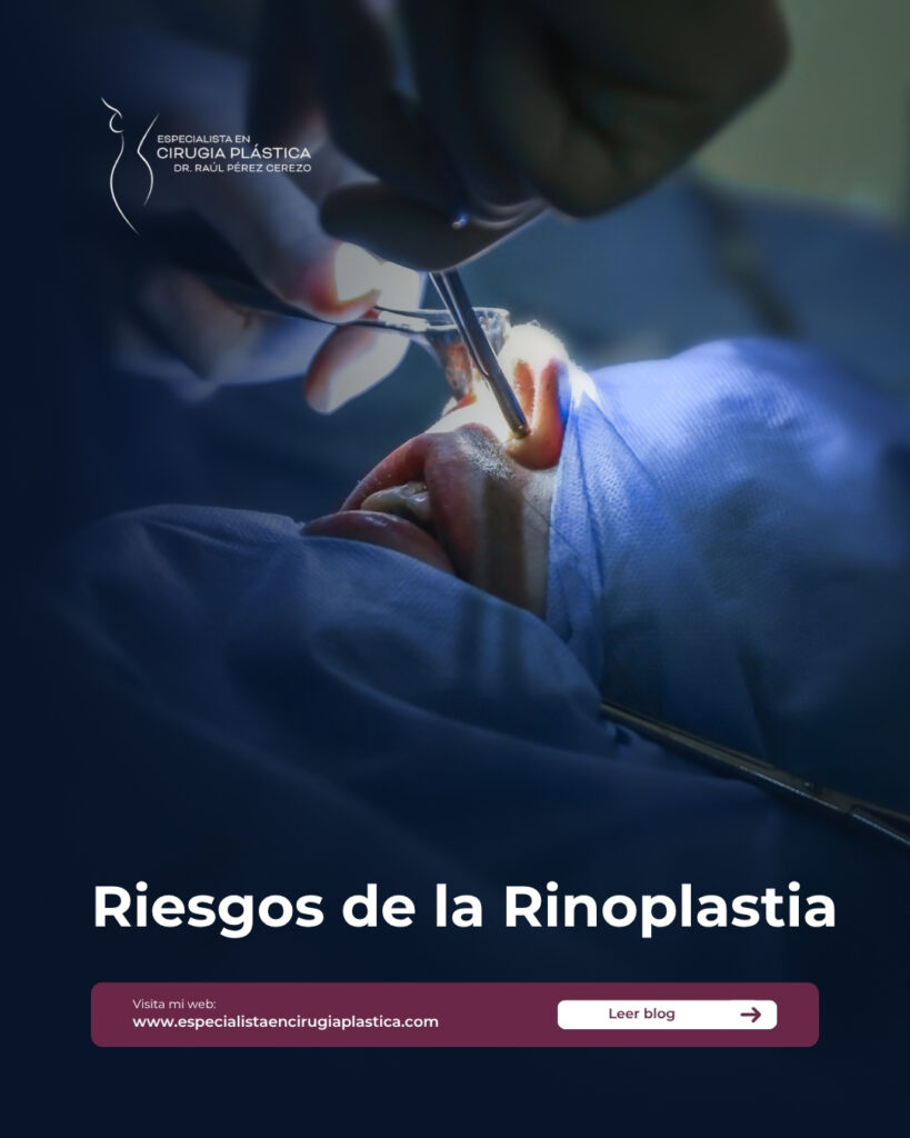 Riesgos de la Rinoplastia