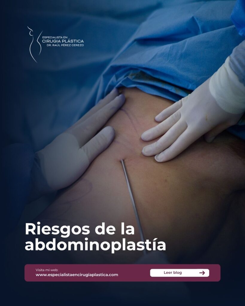 Riesgos de la abdominoplastía Riesgos de la abdominoplastía