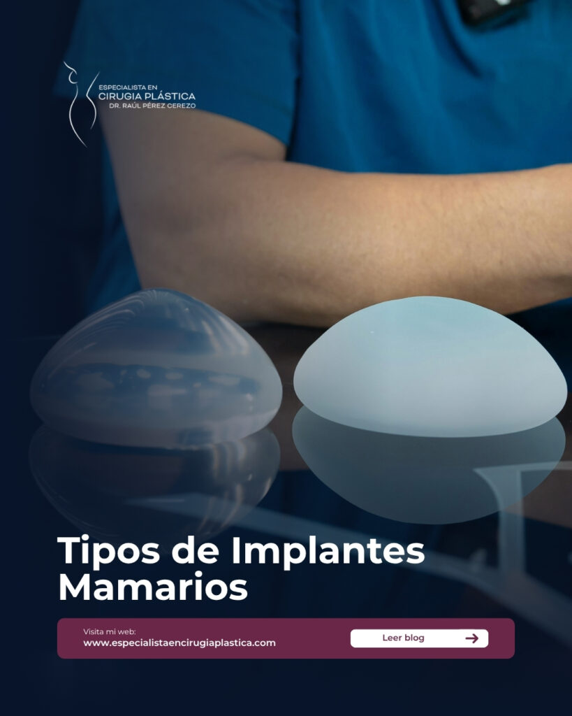 Tipos de implantes mamarios