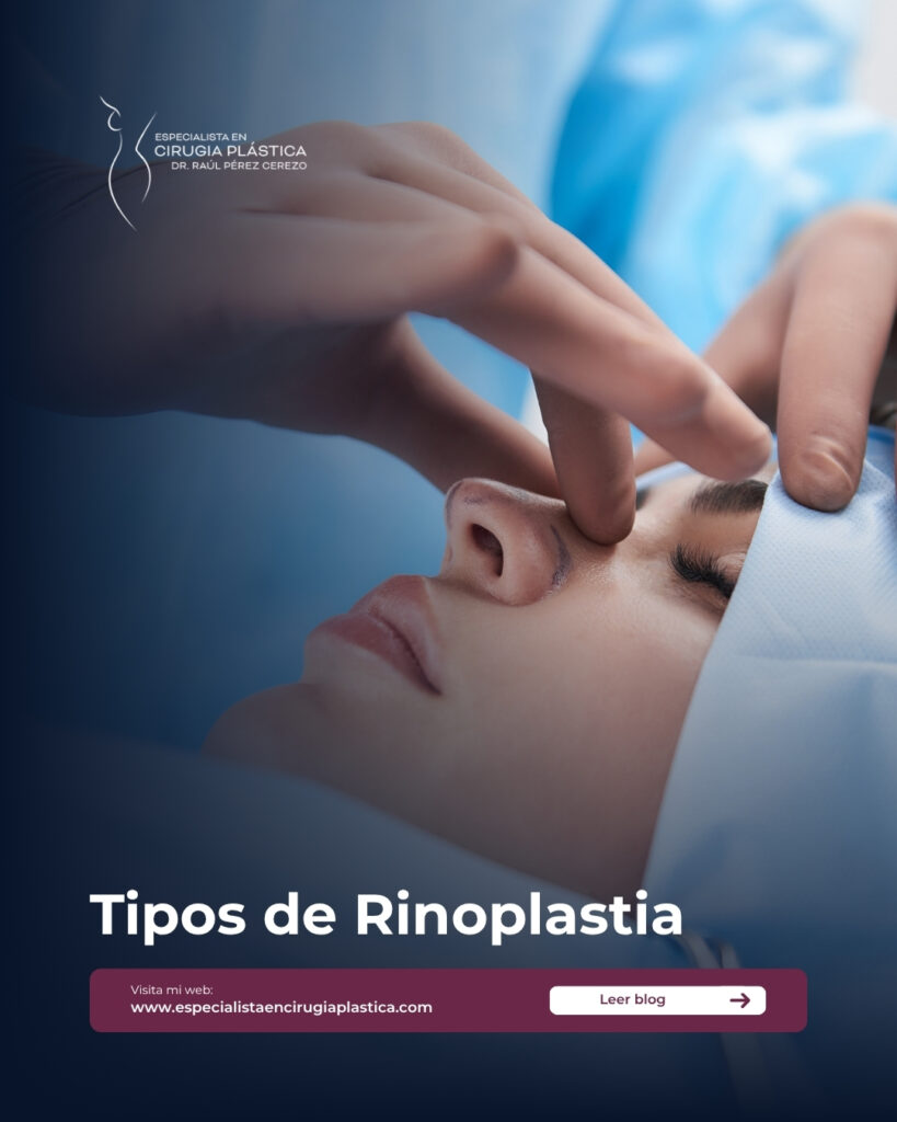 Tipos de Rinoplastia Tipos de Rinoplastia