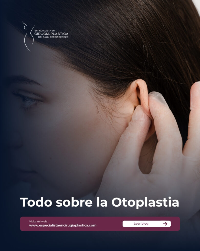 Todo sobre la Otoplastia Todo sobre la Otoplastia