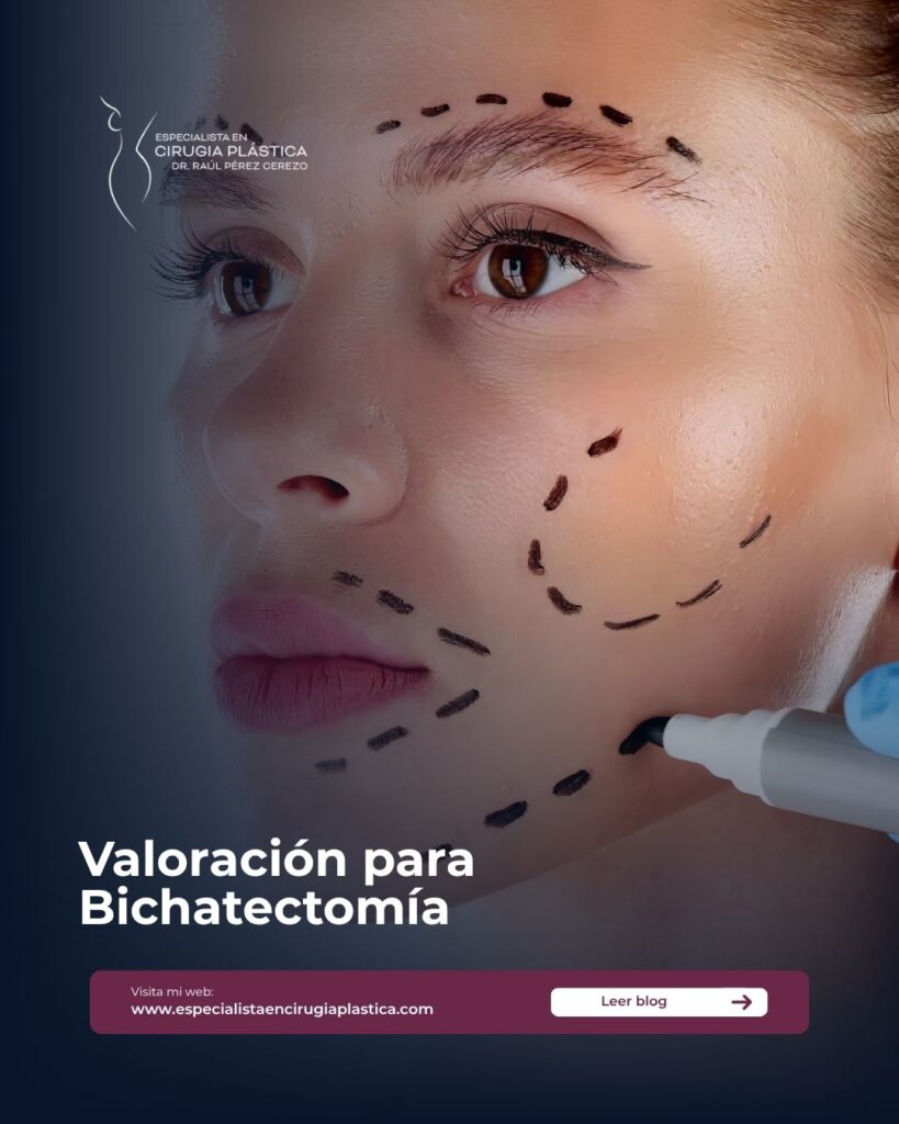 Valoración para Bichatectomía