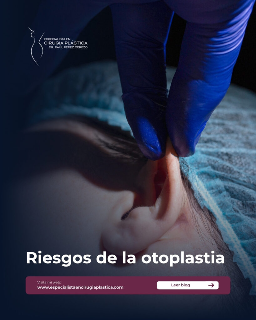 riesgos de la otoplastia