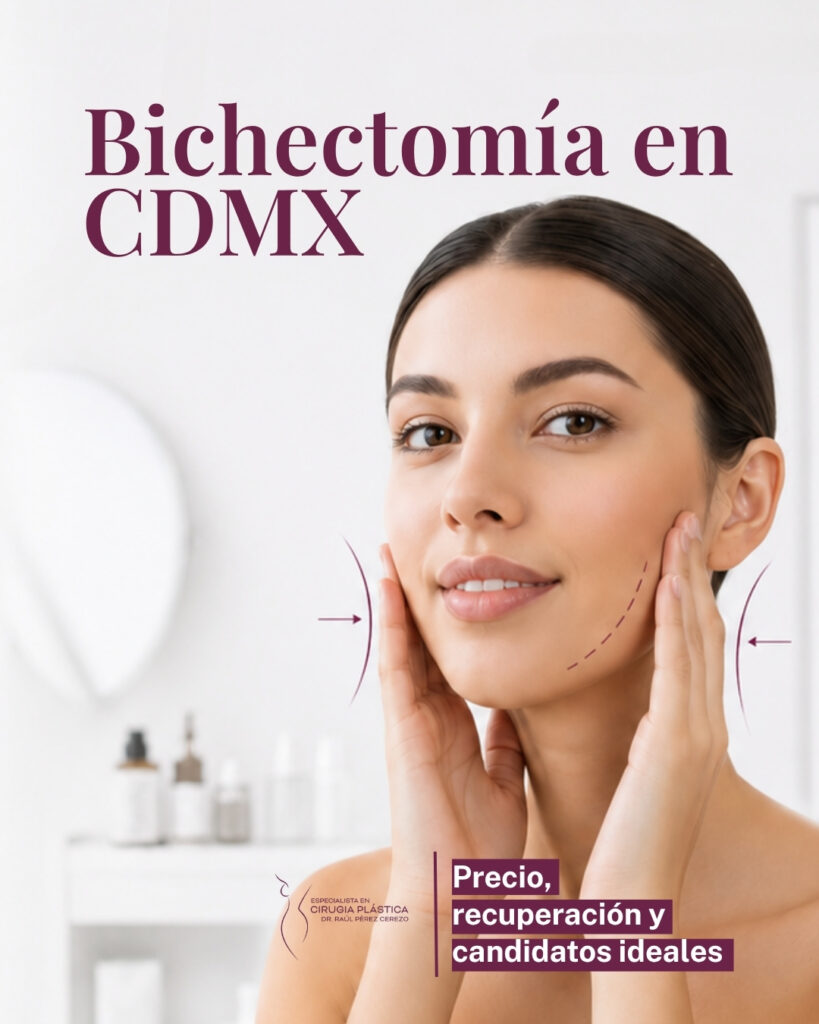 Bichectomía