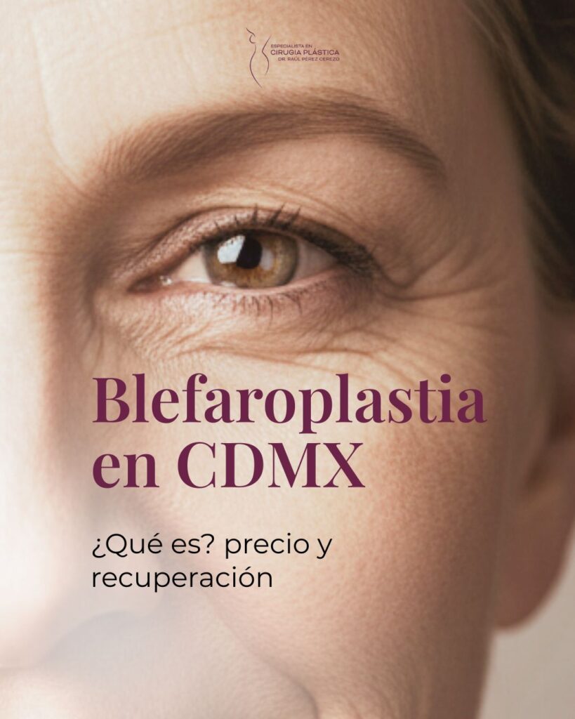 blefaroplastia blefaroplastia