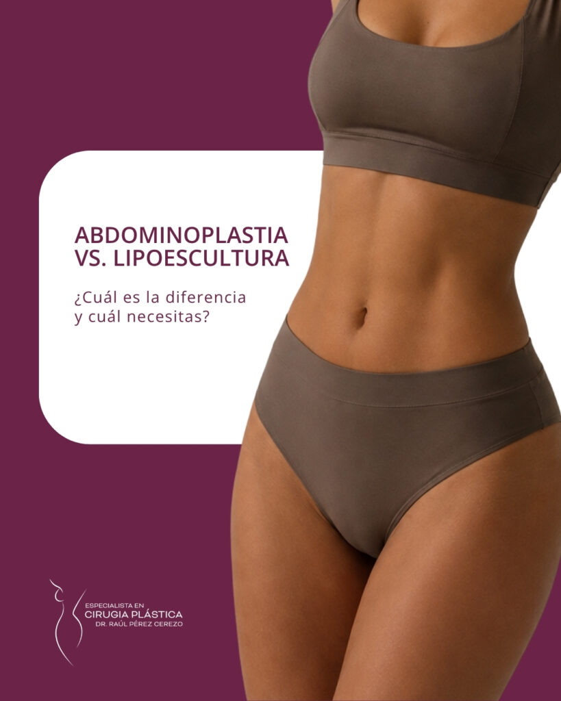 Transferencia de Grasa a Glúteos
