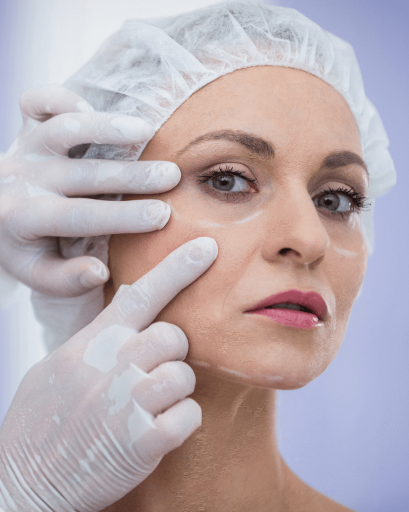 Blefaroplastia en CDMX