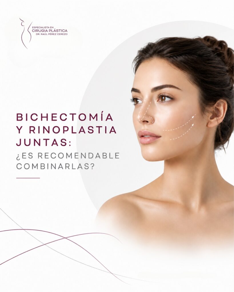 Bichectomía y Rinoplastia