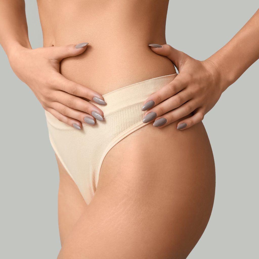 Abdominoplastia